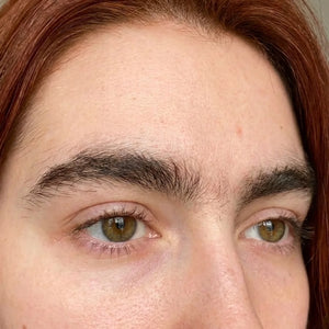 Antes