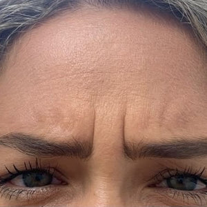 Antes